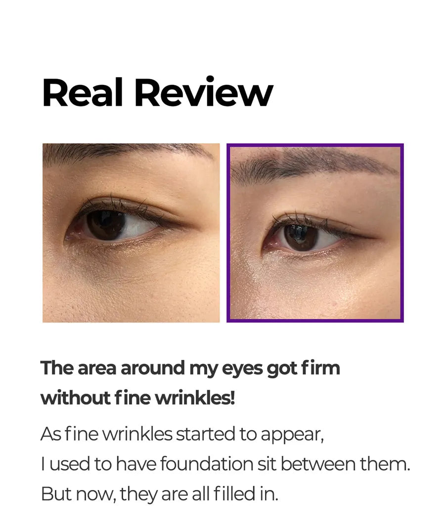 SOME BY MI Retinol Intense Advanced Triple Action Eye Cream 30ml - Fine Lines and Dark Circles Care